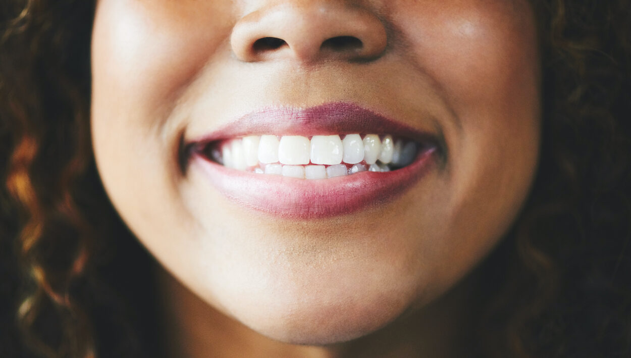 Closeup of a curly-haired woman's smile that is cavity-free and healthy