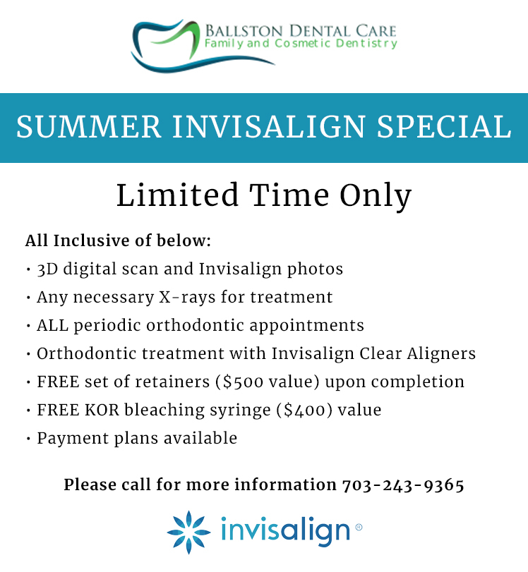 Summer Invisalign Special. Please call for more info 703-243-9365